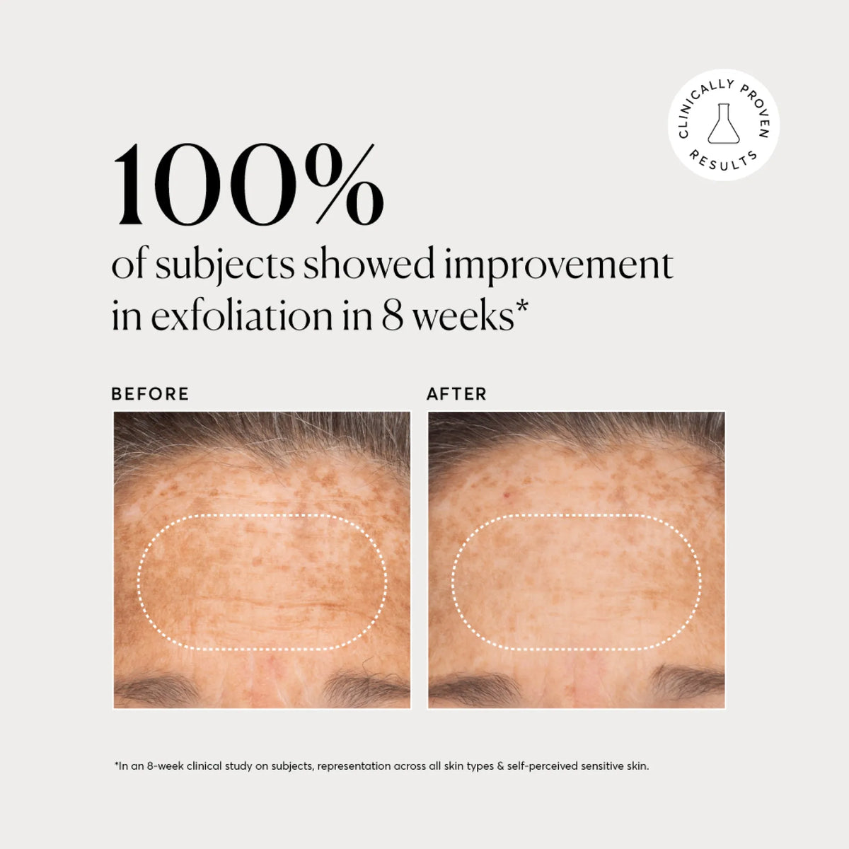 bha-liquid-exfoliant-2-y3 NATR-10027-Alt-Images-BHA-Liquid-Exfoliant-2_-03.webp